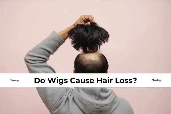 Do Wigs Cause Hair Loss?
